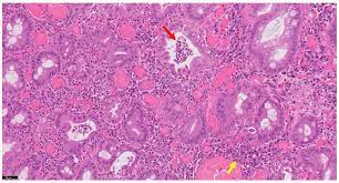 ΙΑΤΡΟΙ ΙΣΤΟΠΑΘΟΛΟΓΟΙ ΚΥΤΤΑΡΟΛΟΓΟΙ SGS DIAGNOSTIC CENTER OFF HISTOPATHOLOGY ΛΕΜΕΣΟΣ